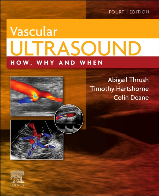 Vascular Ultrasound : How, Why and When, Hardback Book
