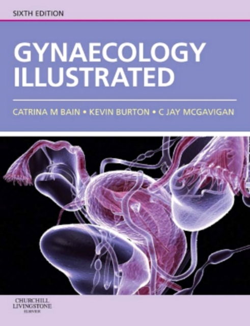 Gynaecology Illustrated : Gynaecology Illustrated E-Book, EPUB eBook