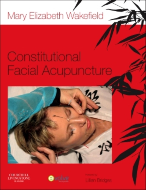Constitutional Facial Acupuncture, Paperback / softback Book