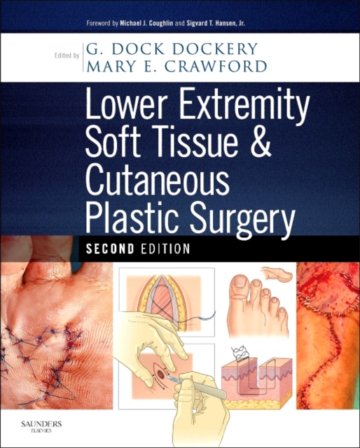 Lower Extremity Soft Tissue & Cutaneous Plastic Surgery, PDF eBook