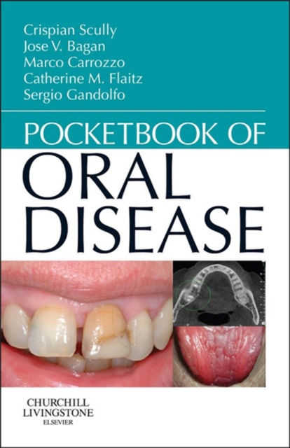 Pocketbook of Oral Disease - E-Book : Pocketbook of Oral Disease - E-Book, EPUB eBook