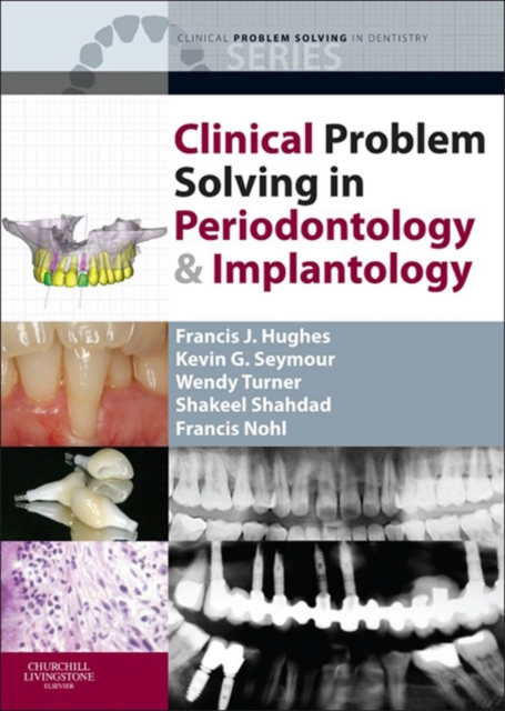 Clinical Problem Solving in Periodontology and Implantology - E-Book, EPUB eBook