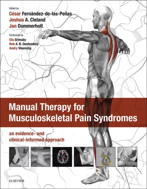 Manual Therapy for Musculoskeletal Pain Syndromes : an evidence- and clinical-informed approach, EPUB eBook
