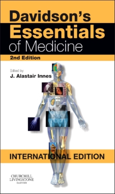 Davidson's Essentials of Medicine, Paperback Book