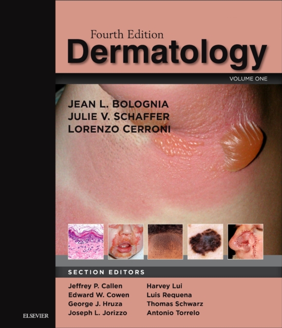 Dermatology E-Book, EPUB eBook