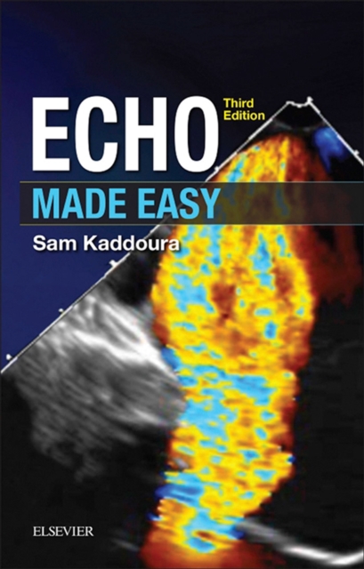 Echo Made Easy : Echo Made Easy E-Book, EPUB eBook