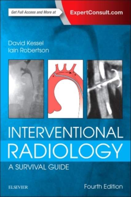 Interventional Radiology: A Survival Guide, Paperback / softback Book