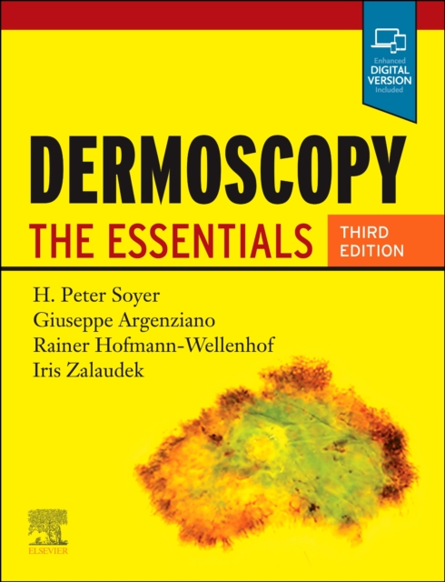 Dermoscopy : The Essentials, Paperback / softback Book