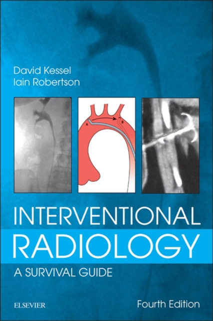 Interventional Radiology: A Survival Guide E-Book, EPUB eBook