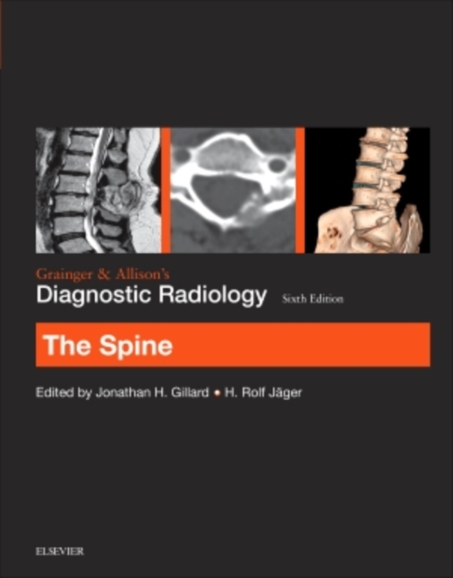 Grainger & Allison's Diagnostic Radiology: The Spine, Paperback / softback Book