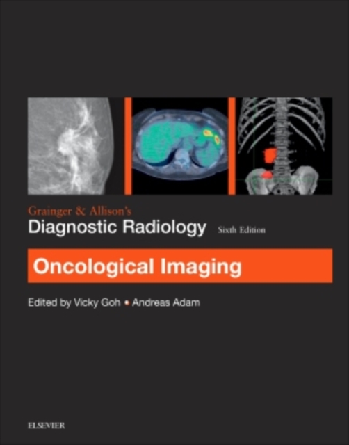Grainger & Allison's Diagnostic Radiology: Oncological Imaging, Paperback / softback Book