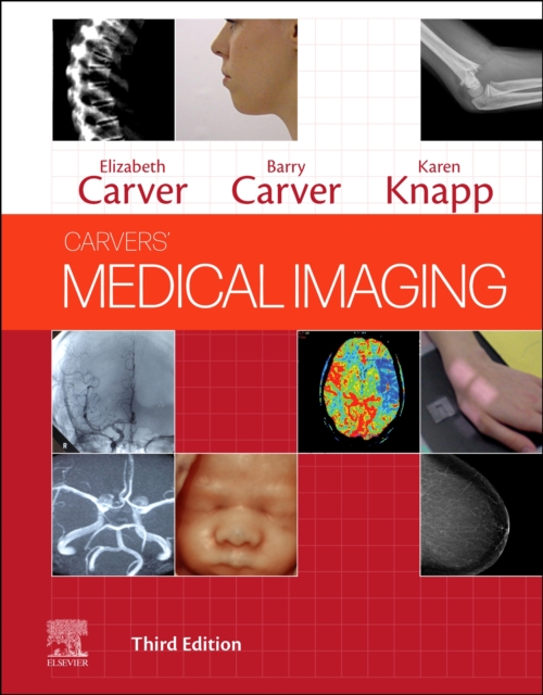 Carvers' Medical Imaging, Hardback Book