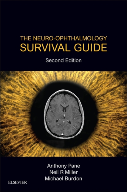 The Neuro-Ophthalmology Survival Guide E-Book : The Neuro-Ophthalmology Survival Guide E-Book, EPUB eBook