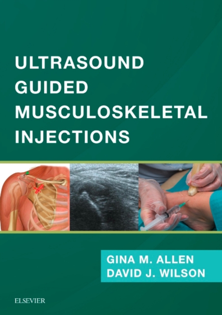Ultrasound Guided Musculoskeletal Injections, EPUB eBook