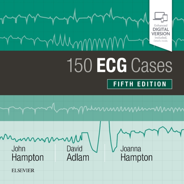 150 ECG Cases, Paperback / softback Book