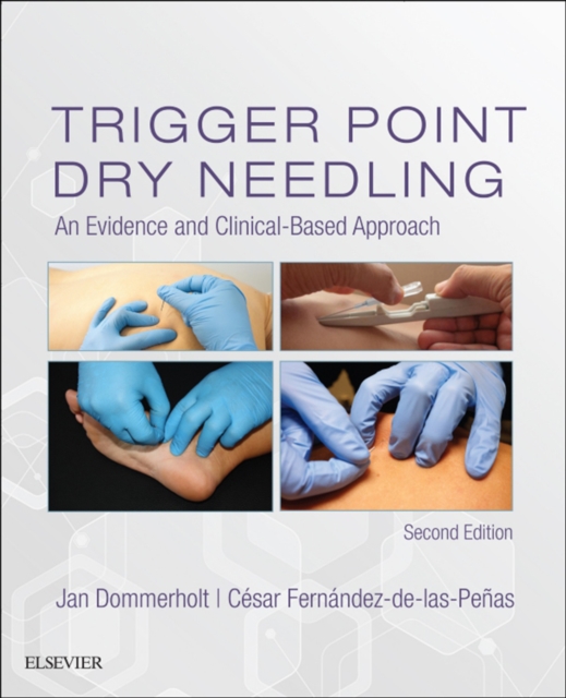 Trigger Point Dry Needling E-Book : Trigger Point Dry Needling E-Book, EPUB eBook