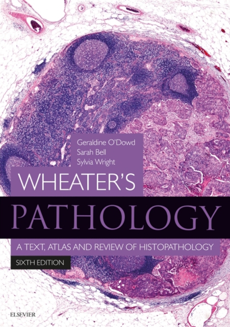 Wheater's Pathology: A Text, Atlas and Review of Histopathology E-Book : Wheater's Pathology: A Text, Atlas and Review of Histopathology E-Book, EPUB eBook