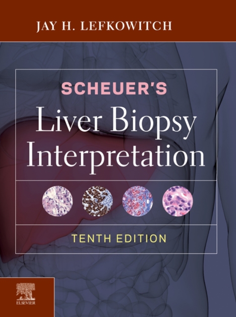 Scheuer's Liver Biopsy Interpretation, EPUB eBook