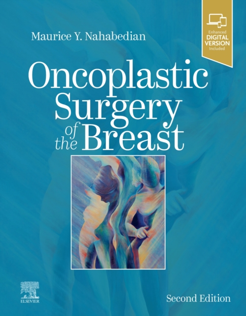 Oncoplastic Surgery of the Breast, Hardback Book