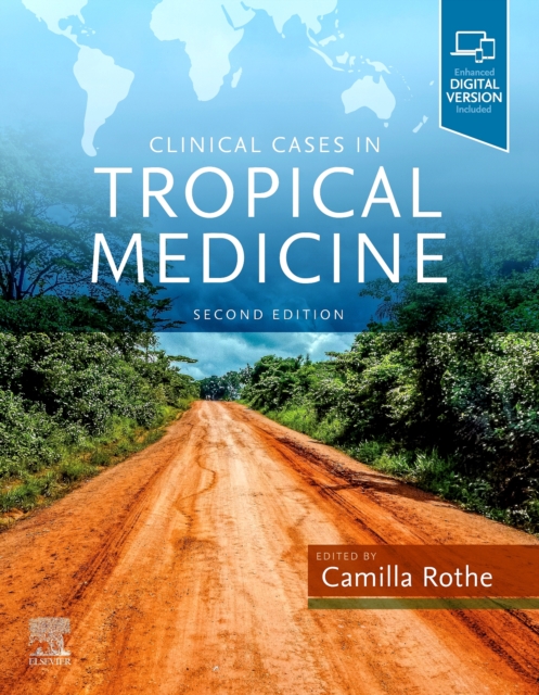Clinical Cases in Tropical Medicine, Paperback / softback Book