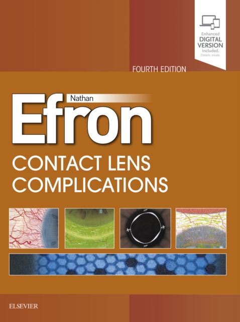 Contact Lens Complications E-Book : Contact Lens Complications E-Book, EPUB eBook