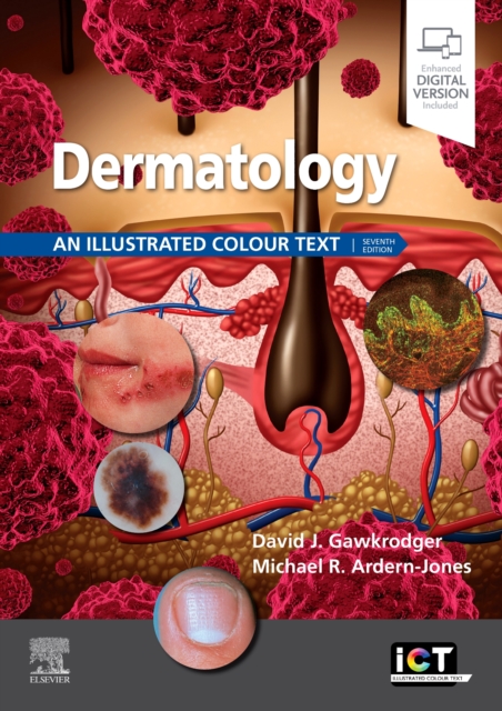 Dermatology : An Illustrated Colour Text, Paperback / softback Book