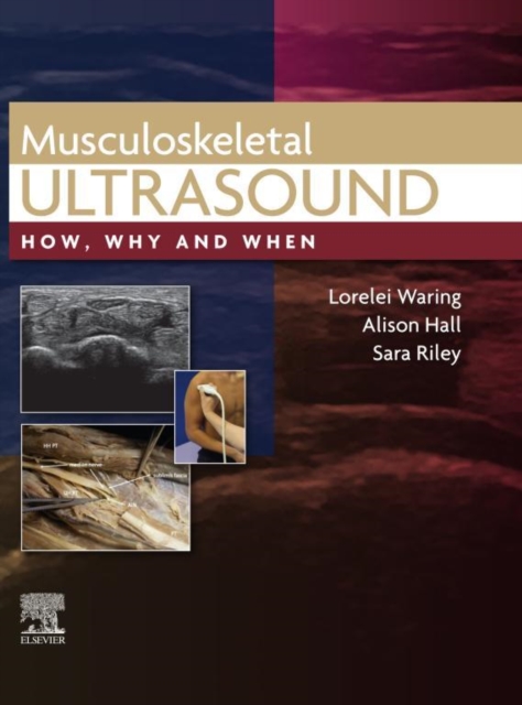 Musculoskeletal Ultrasound, E-Book : Musculoskeletal Ultrasound, E-Book, EPUB eBook