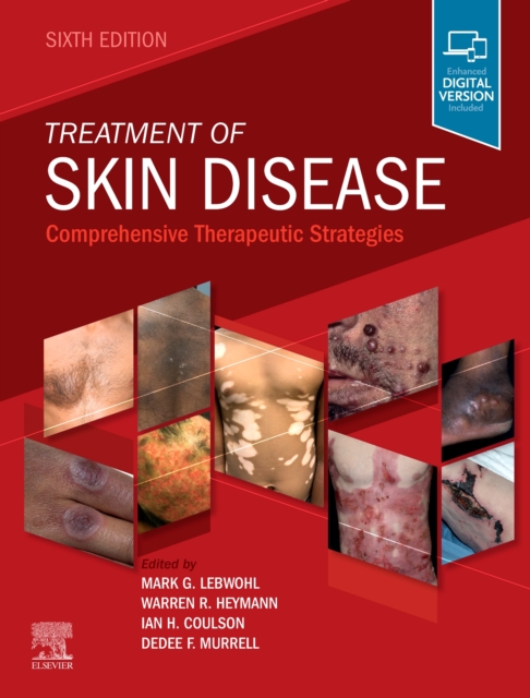 Treatment of Skin Disease : Comprehensive Therapeutic Strategies, Hardback Book