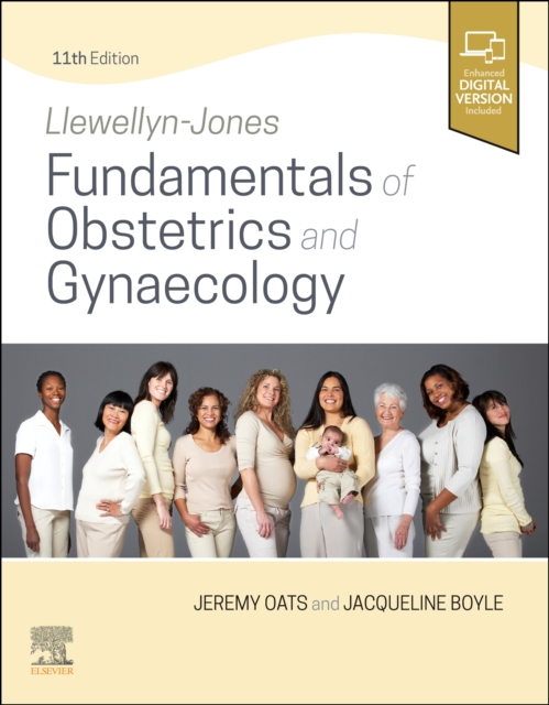 Llewellyn-Jones Fundamentals of Obstetrics and Gynaecology, Paperback / softback Book