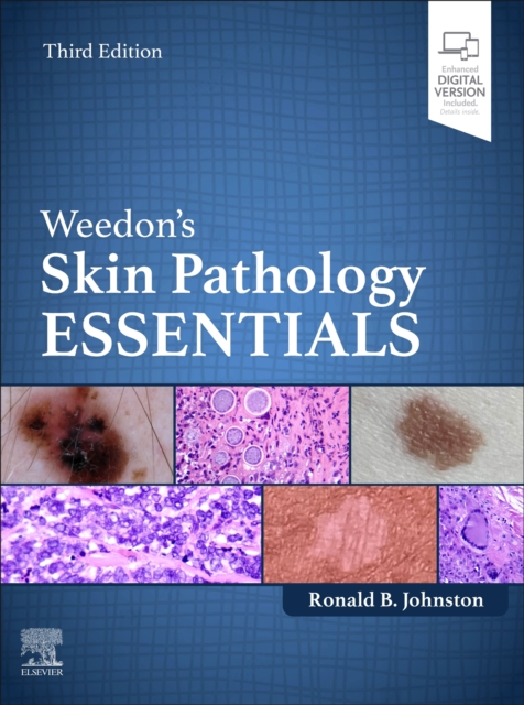 Weedon's Skin Pathology Essentials, Hardback Book