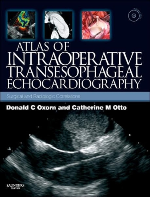 Atlas of Intraoperative Transesophageal Echocardiography : Surgical and Radiologic Correlations, Mixed media product Book