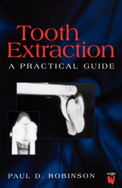 Tooth Extraction : A Practical Guide, Paperback / softback Book