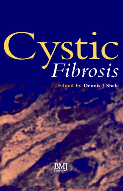 Cystic Fibrosis, Hardback Book