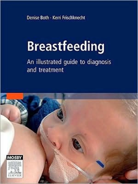 Breastfeeding : An Atlas of Diagnosis and Treatment, Hardback Book