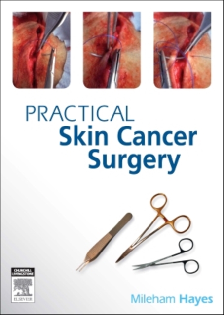 Practical Skin Cancer Surgery, Paperback / softback Book