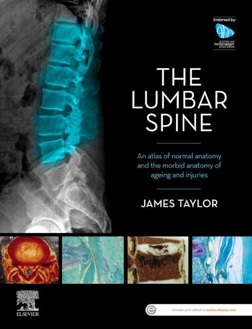 The Lumbar Spine : An Atlas of Normal Anatomy and the Morbid Anatomy of Ageing and Injury, Paperback / softback Book