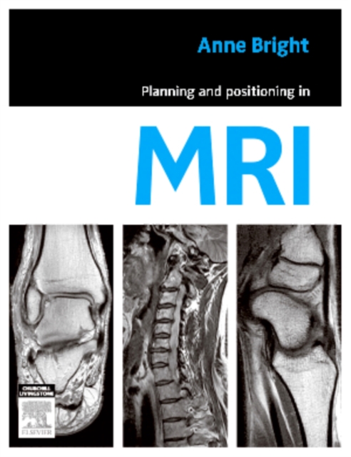 Planning and Positioning in MRI - E-Book, EPUB eBook