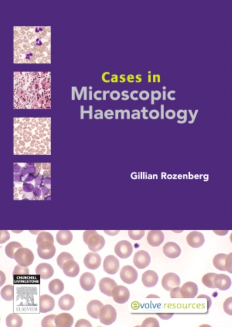 Cases in Microscopic Haematology - E-Book, EPUB eBook