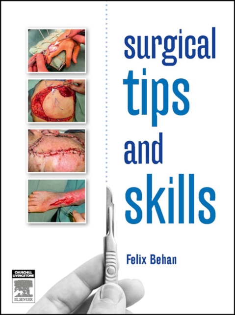 Surgical tips and skills - eBook, EPUB eBook