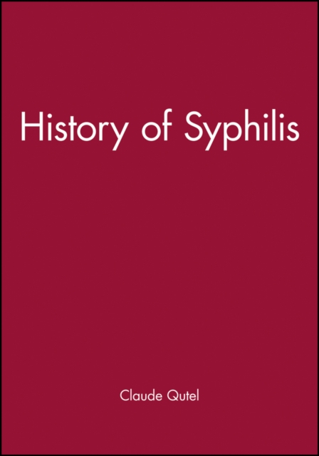 History of Syphilis, Paperback / softback Book