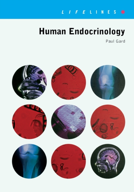 Human Endocrinology, Paperback / softback Book