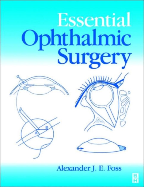 Essential Ophthalmic Surgery, Paperback / softback Book