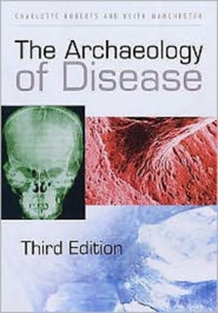 The Archaeology of Disease, Hardback Book