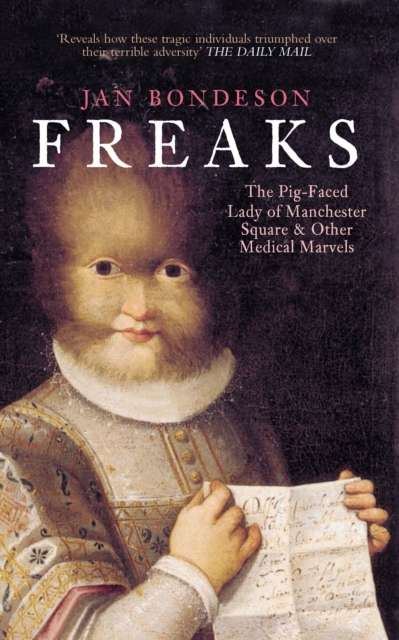 Freaks : The Pig-Faced Lady of Manchester Square and Other Medical Marvels, Paperback / softback Book