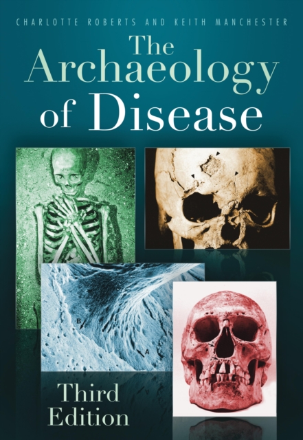 The Archaeology of Disease, EPUB eBook