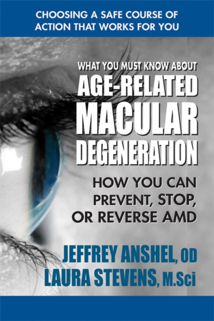 What You Must Know About Age-Related Macular Degenration : How You Can Prevent, Stop, or Reverse Amd, Paperback / softback Book