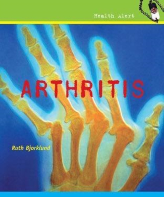Arthritis, PDF eBook