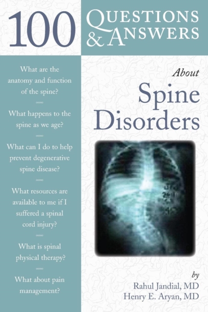 100 Questions  &  Answers About Spine Disorders, Paperback / softback Book