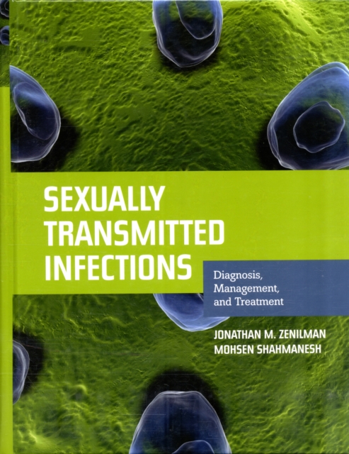 Sexually Transmitted Infections: Diagnosis, Management, and Treatment : Diagnosis, Management, and Treatment, Hardback Book