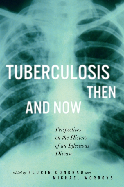 Tuberculosis Then and Now : Perspectives on the History of an Infectious Disease Volume 36, Paperback / softback Book